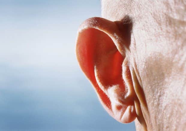 If your ear lobe looks like this, you could be at higher risk of a stroke