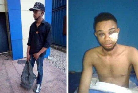 Man narrates how Nigerian police officers tortured him over false accusation