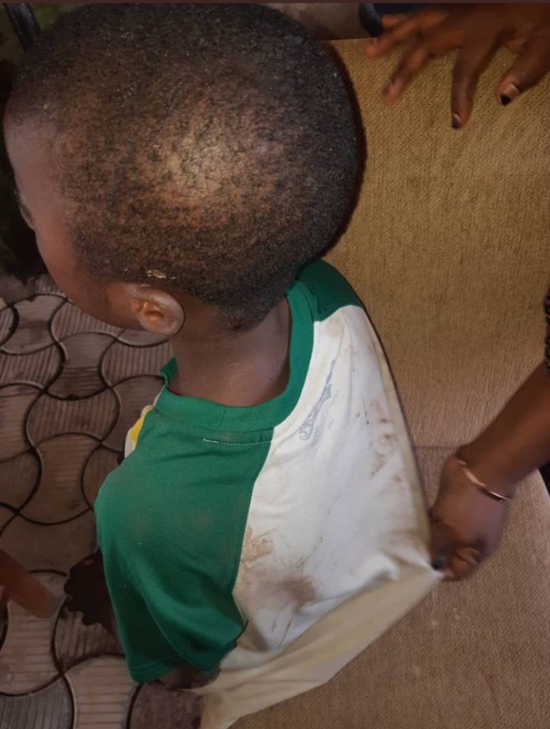 Abuja boy beaten by madam