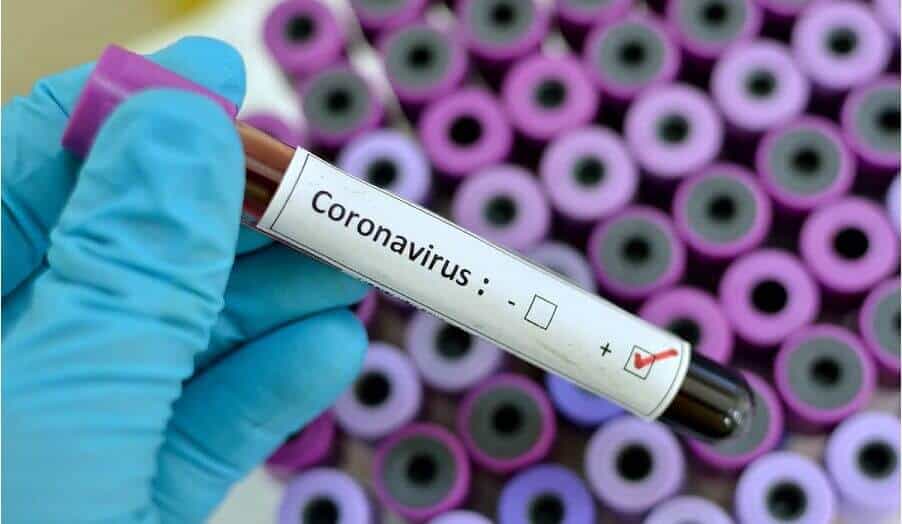 Coronavirus Celebrity Leaks