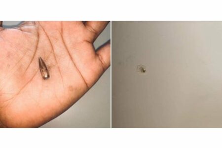 woman shares stray bullet experience