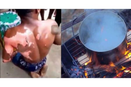 Woman pours hot water on her husband