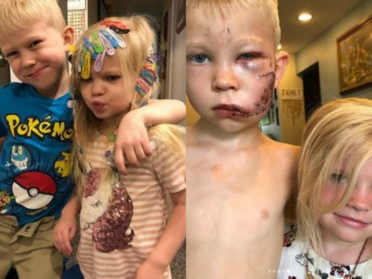the boy who saved sister from dog attack