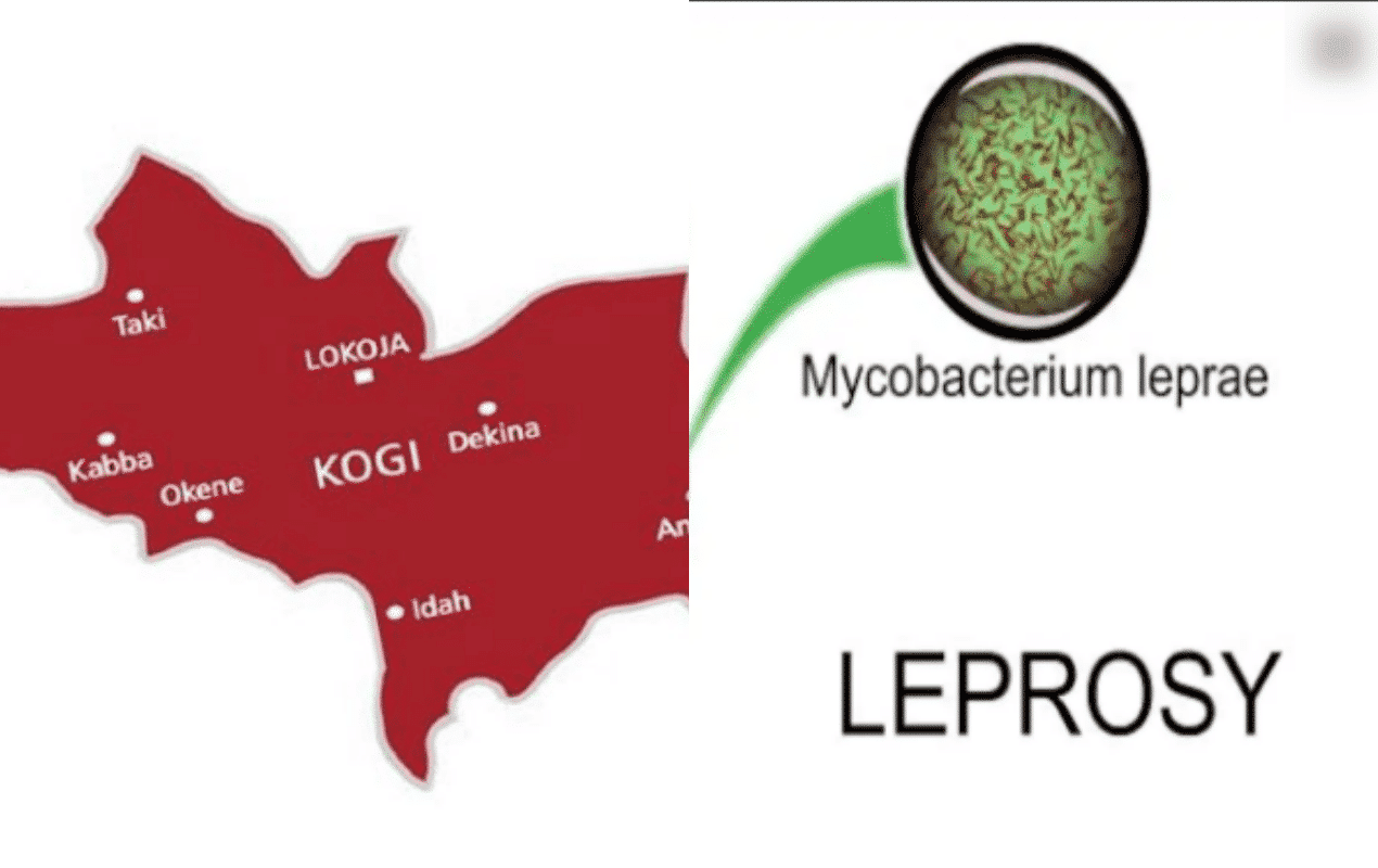 Leprosy in Kogi