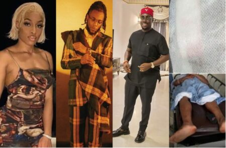 Married lady who Burna Boy assaulted speaks out