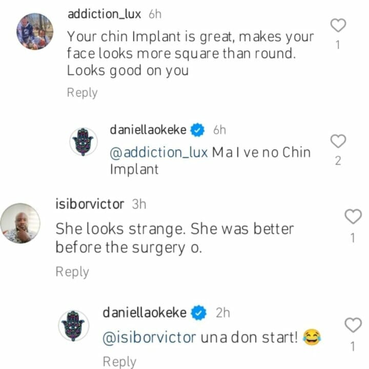 Danielle Okeke speaks on having chin implant