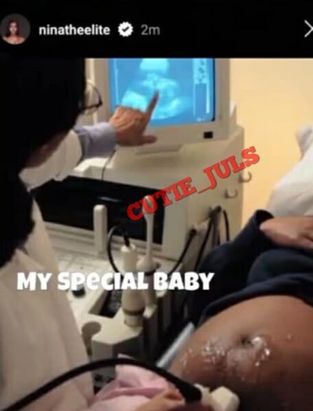 Anita Brown s fake pregnancy scan